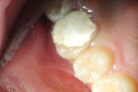 Aspecto Clínico Inicial