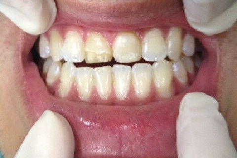 Estado inicial do paciente.