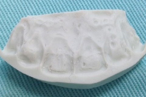 Visão interna da guia palatina.