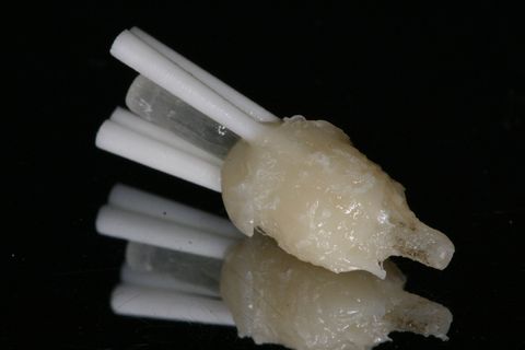 Aspecto final do pino pós fotopolimerização