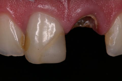 Aspecto Clínico Inicial