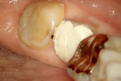 Condição clínica inicial