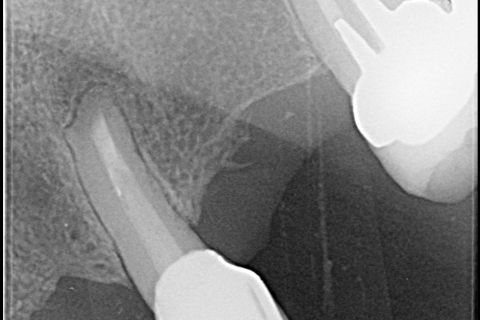 Acompanhamento após 6 meses