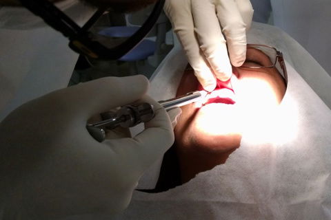 Técnica anestésica: Infiltrativa com Lidocaína 2%