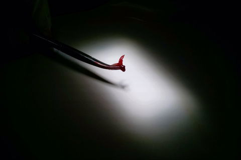 Freio removido preso à pinça hemostática