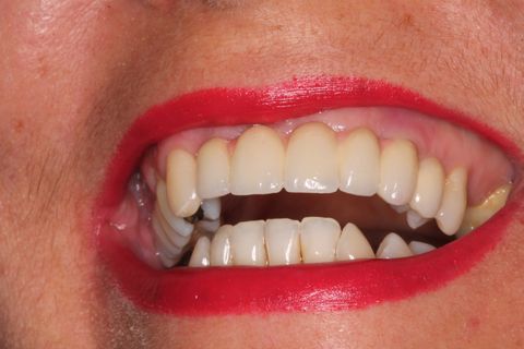 alegria e satisfação da paciente