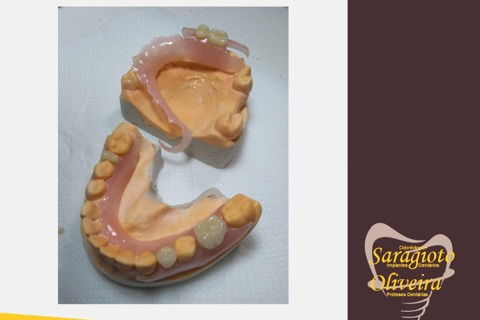 Proteses Dentárias