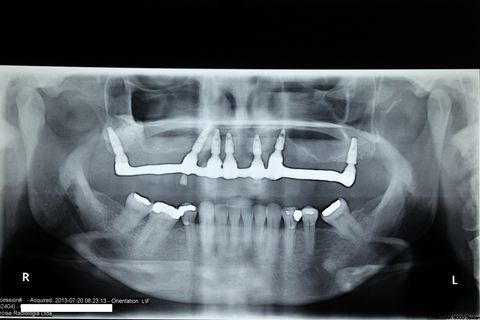 Panorâmica de controle de 2013, breve incluirei controle desse ano.