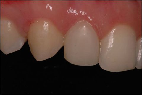 Unidade 1.2 finalizada