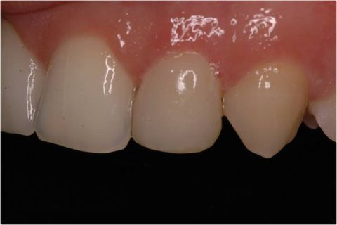 Unidade 2,2 finalizada