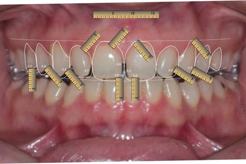 Digital Smile Design - DSD