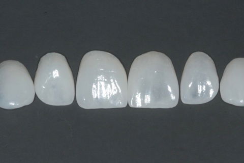 Laminados Cerâmicos