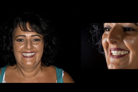 Aspecto do caso finalizado.