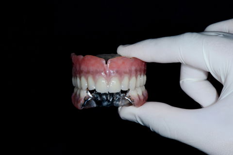 Prótese total e prótese parcial removível finalizadas.