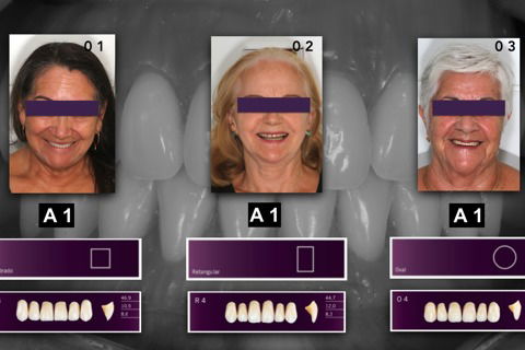 Escolha dos dentes através da análise facial e aspectos intra-bucais