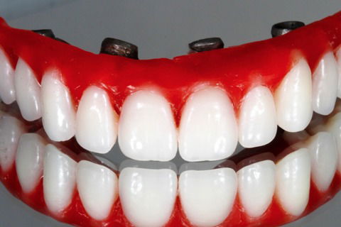 Prova da barra e dos dentes