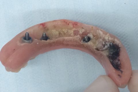 Ausencia total de higiene