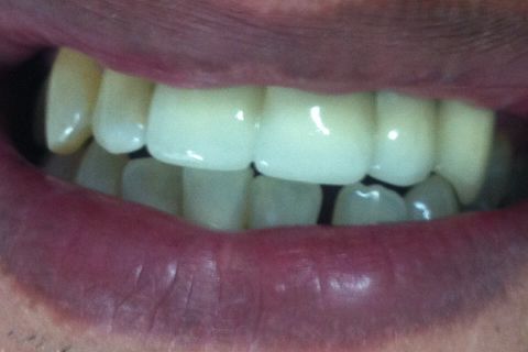 Finalização do trabalho.